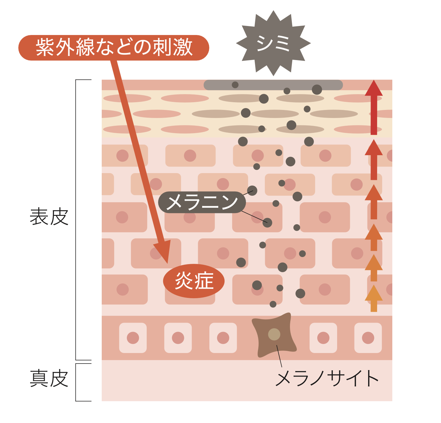 肌の断面図。紫外線などの刺激で炎症が起こり、表皮の基底層にあるメラノサイトがメラニンをつくり、シミとして現れるまでの流れ